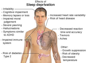 Image courtesy of http://sleepzine.com